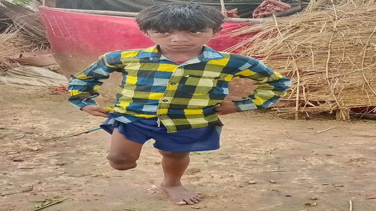 Jamui: दिव्यांग छात्रा सीमा को मिली मदद तो अमित को भी अब आस, सरकारी सहायता के लिए वायरल होने का इंतजार