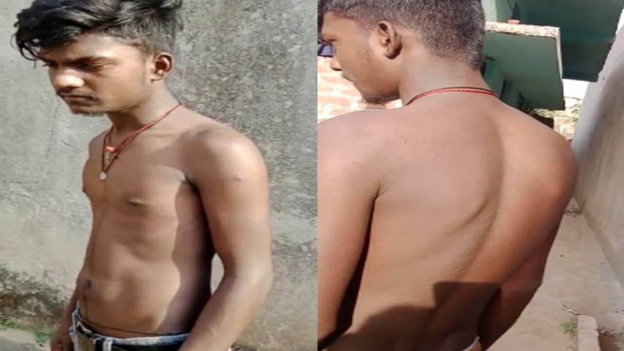 Jharkhand news: गुमला में अपराधी की जगह छात्र को पकड़कर बेरहमी से पुलिस ने की पिटाई, लोगों में आक्रोश