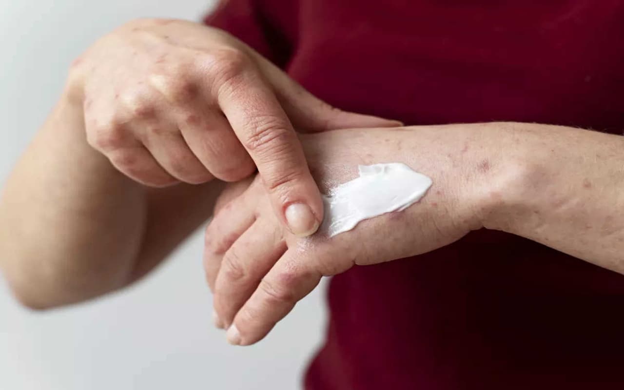 जल्दी ठीक नहीं हो रहा है घाव, तो अपनायें इन आयुर्वेदिक उपायों को