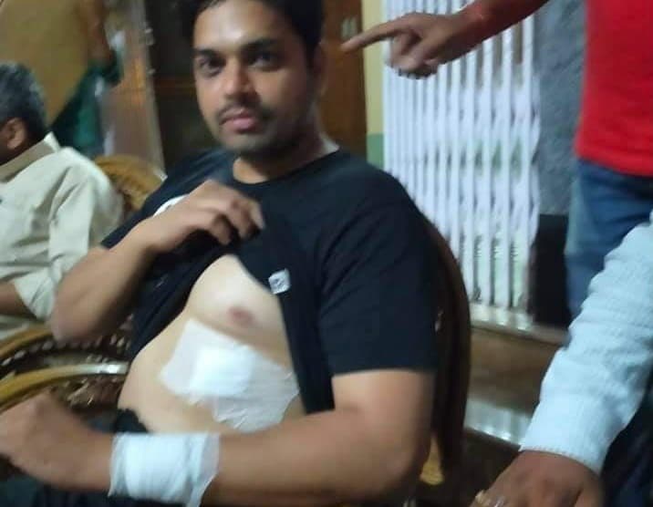 झारखंड के गोड्डा विधायक अमित मंडल पर भागलपुर में जानलेवा हमला, गंभीर रूप से जख्मी