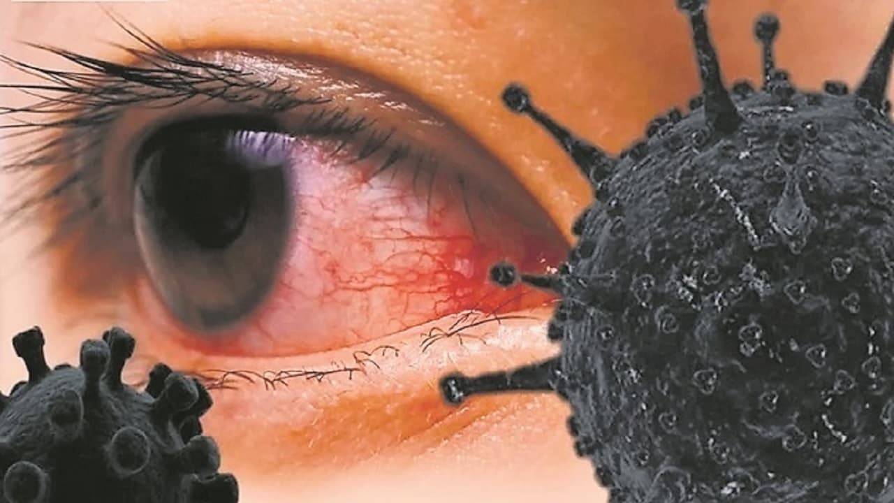 पटना में ब्लैक फंगस के मरीज की आंख व जबड़े को बाहर निकाला, मौत के बाद अब अस्पताल को शोकॉज, जानें वजह