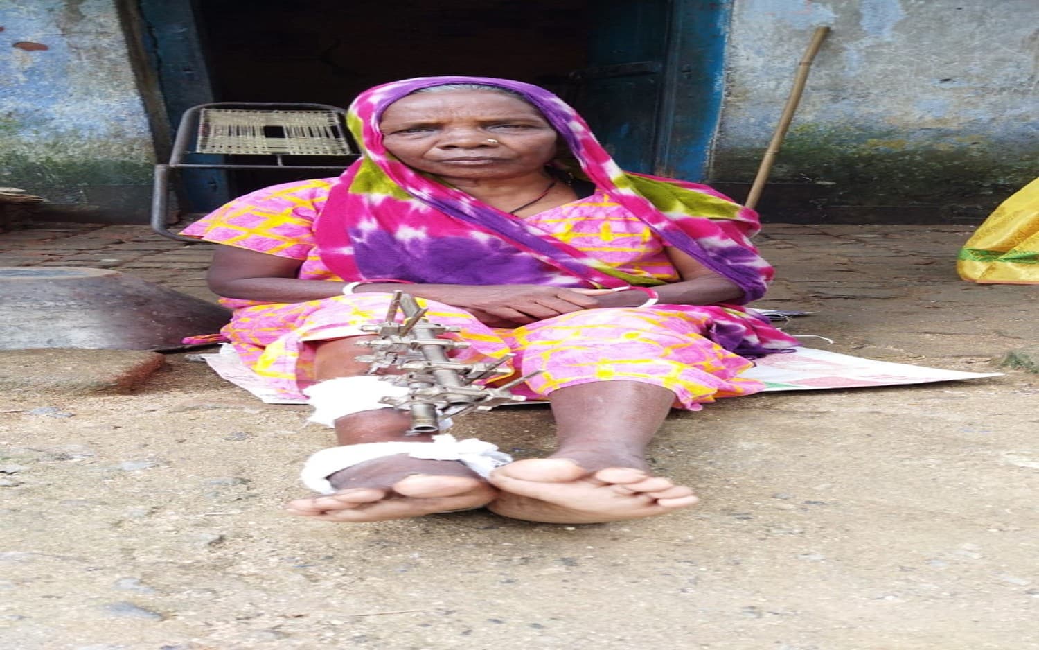 बोकारो की विधवा नहीं दे पायी पूरा पैसा तो अस्पताल ने भगाया, 11 माह से झेल रही यंत्रणा