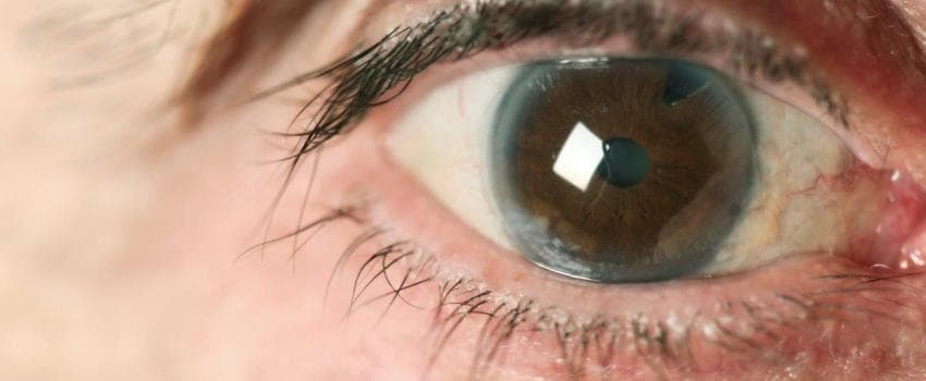 मुजफ्फरपुर के एक निजी अस्पताल ने छीनी रोशनी, 65 का मोतियाबिंद ऑपरेशन, 26 को इन्फेक्शन, 4 की निकालनी पड़ी आंखें