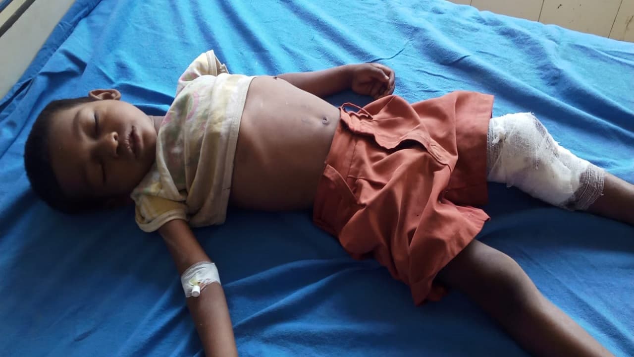 Jharkhand News: खेल रहे बच्चों पर गिरी 
कच्चे मकान की दीवार, दो मासूमों की मौत, एक बच्चे की हालत नाजुक