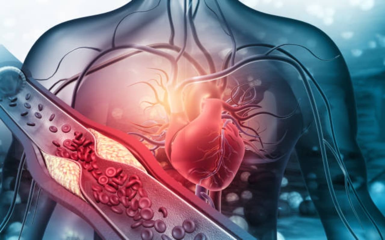 Health Care : दिल पर कहर ढाता है खराब कोलेस्ट्रॉल, नेचुरली कम करने के जानिए उपाय Health Care : दिल पर कहर ढाता है खराब कोलेस्ट्रॉल, नेचुरली कम करने के जानिए उपाय