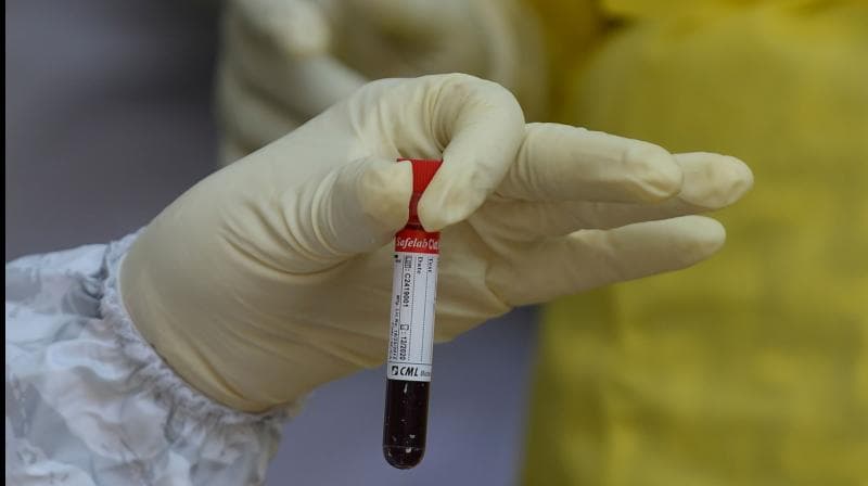 Coronavirus LIVE: मुंबई में कोरोना वायरस संक्रमण के सात नए मामले सामने आये