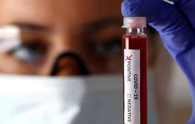 कोविड-19 दवाओं की जांच को गति दे सकती है ‘चिप पर लगी कोशिका की झिल्ली' : शोध