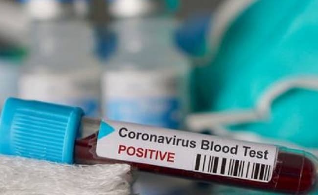 कोरोना से रिकवर होकर भी मरीज परेशान, किसी के झड़ रहे बाल, तो किसी को हंफनी की शिकायत