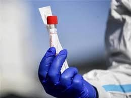 Coronavirus: लखनऊ में कोरोना वायरस से एक और व्यक्ति संक्रमित, मरीजों की संख्या दो हुई