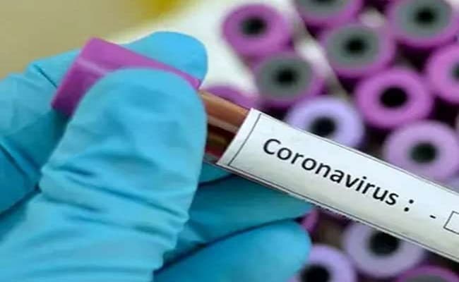 Coronavirus : मुंबई में 53 मीडियाकर्मी भी आये कोरोना वायरस की चपेट में, अधिकतर में कोई लक्षण नहीं
