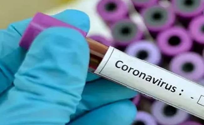 Coronavirus Updates : कोरोना की चपेट में ढाई साल का बच्चा, लखनऊ के केजीएमयू में चल रहा इलाज