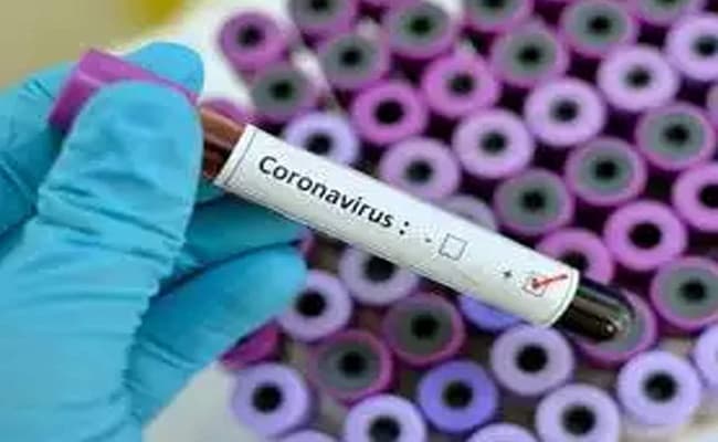 Corona UP News Updates : मेरठ में कोरोना संक्रमित की मौत, श्मशान घाट पर पूरी रात एंबुलेंस में रखा रहा शव