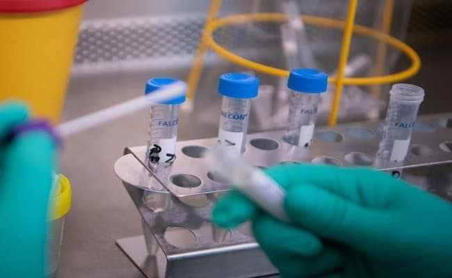 बिहार: खतरनाक स्वाइन फ्लू की चपेट में नवजात बच्ची से लेकर बुजुर्ग तक, कोरोना के भी मामले बढ़े..