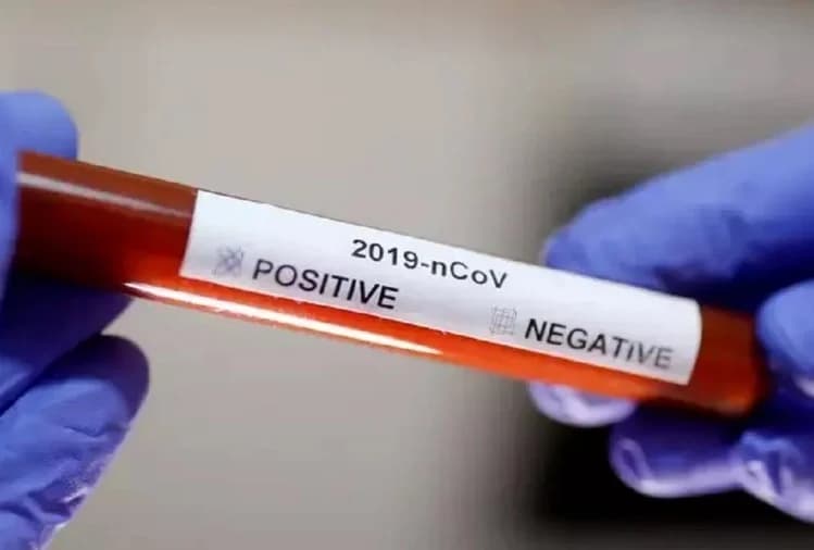 कोरोना जांच के लिए आगे आयें, नहीं तो बरती जायेगी सख्ती