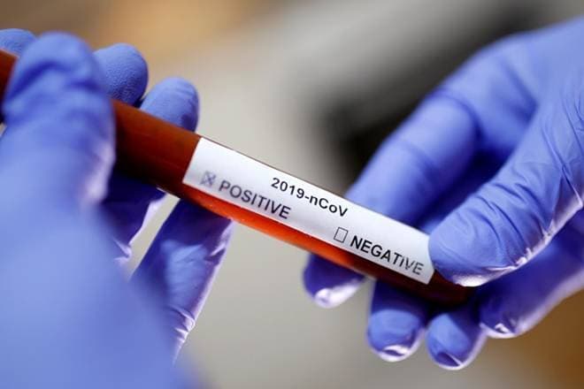 डीआरडीए की महिलाकर्मी सहित पांच नये कोरोना मरीज मिले