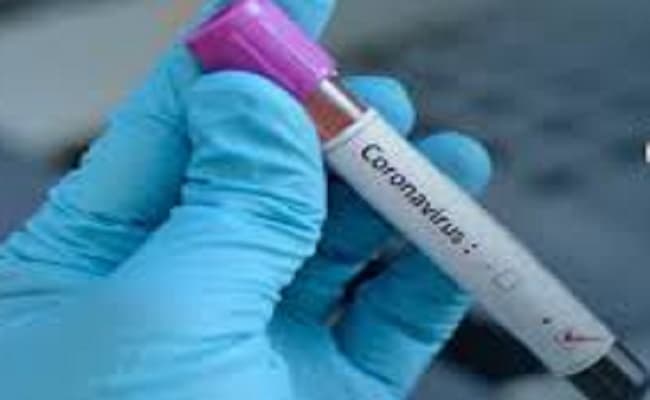 COVID-19 : झोला छाप डॉक्टरों को कोरोना के इलाज में लगाने पर सिविल सर्जन सस्पेंड