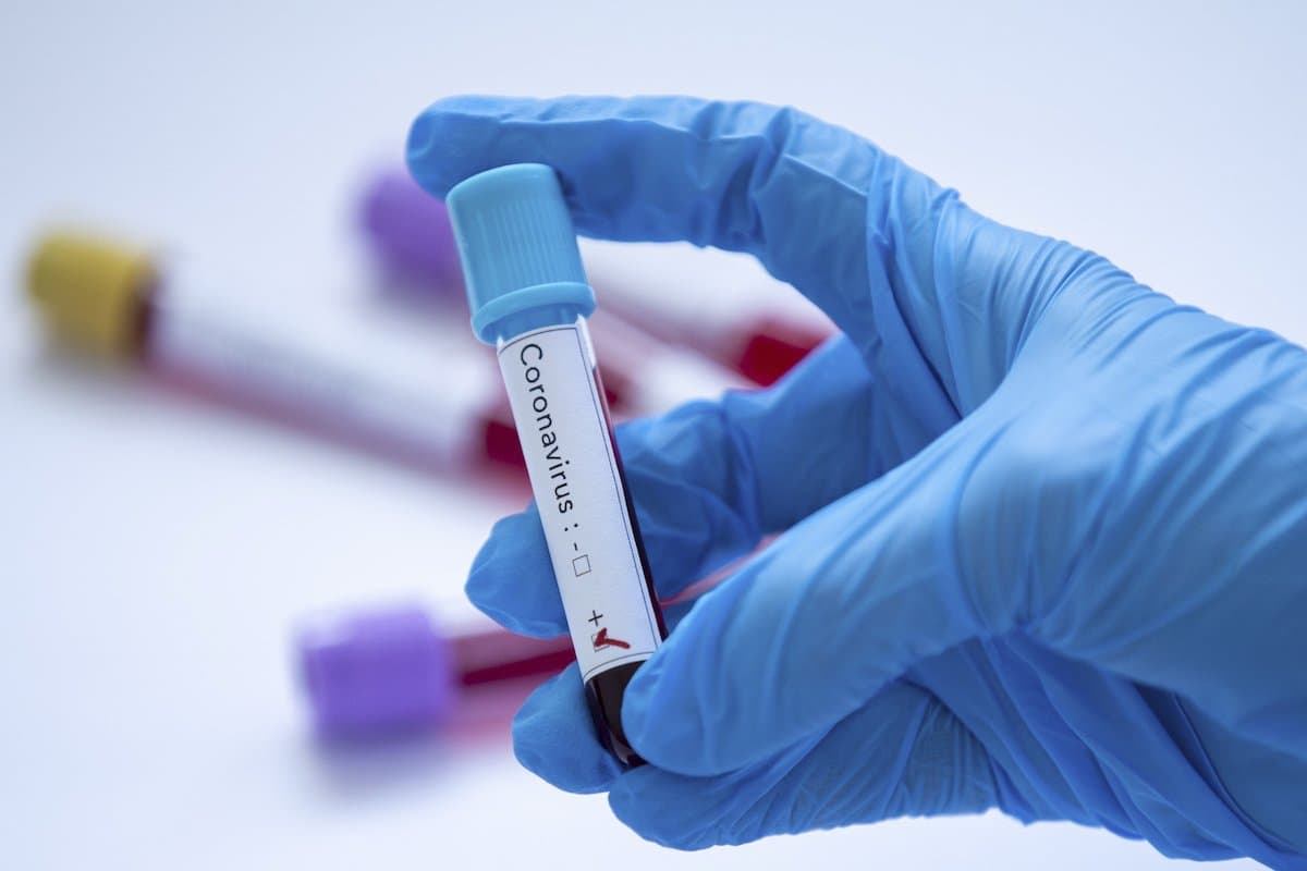 Coronavirus Update: पश्चिम बंगाल में 2,949 नये मामले, 51 लोगों की मौत