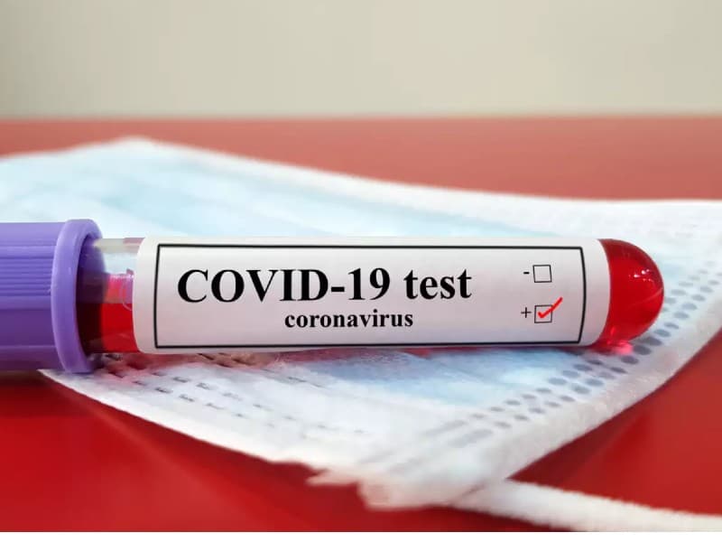 गुमला जिले में अभी भी 316 एक्टिव मरीज हैं, कोरोना  के 1570 में 1292 मरीज ठीक होकर घर गये