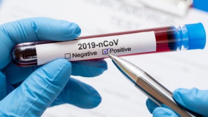 ड्यूटी पर तैनात डॉक्टर ने खुद चलाई ट्रैक्टर जब निगमकर्मी ने कोरोना संक्रमित शव ले जाने से किया इनकार : VIDEO