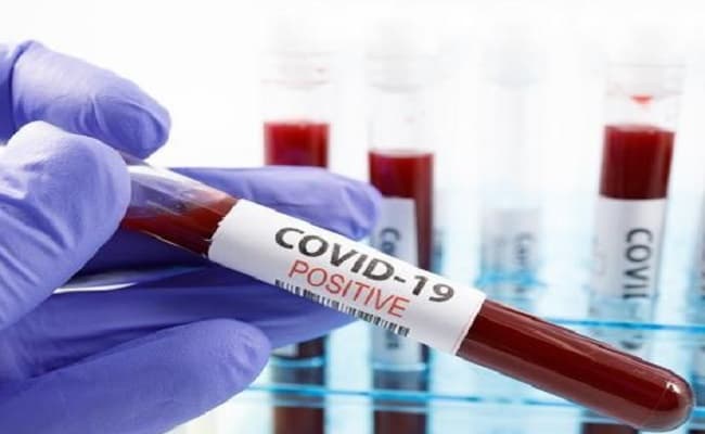Coronavirus Lockdown 2.0 Bihar : छपरा जिले के सीवान की सीमा से सटे गांवों में घर-घर होगा सर्वे