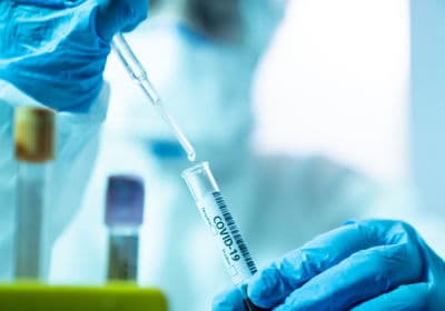 सीआइडी ने लिया था रिमांड पर, आरोपी निकला पॉजिटिव