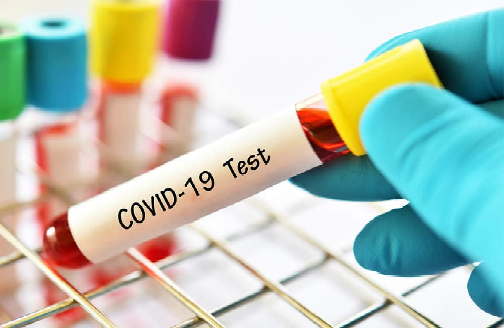 Coronavirus in Bihar: अब 24 घंटे में आयेगी जांच रिपोर्ट, 5000 बढ़ेंगे कोविड स्पेशल बेड
