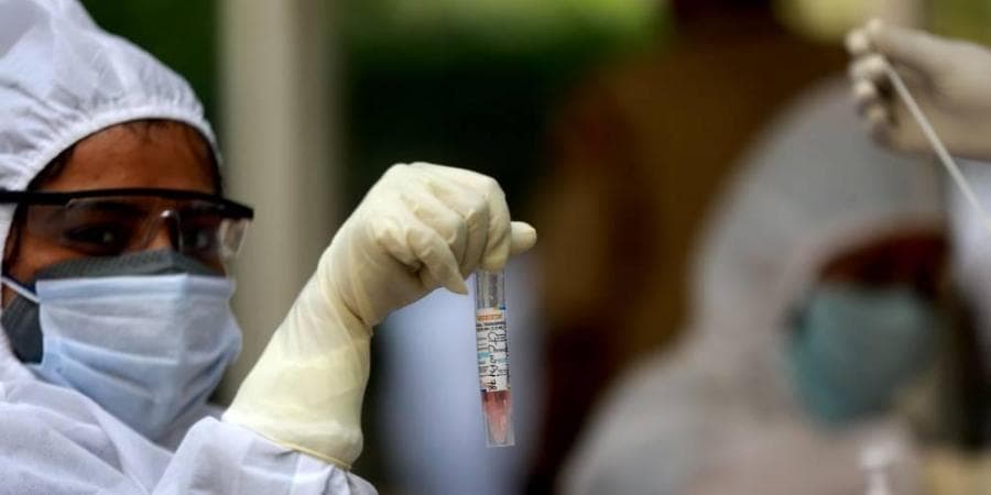Coronavirus LIVE Updates : महाराष्ट्र में पिछले 24 घंटे में कोरोना के 15 हजार नये मामले, 88 की मौत