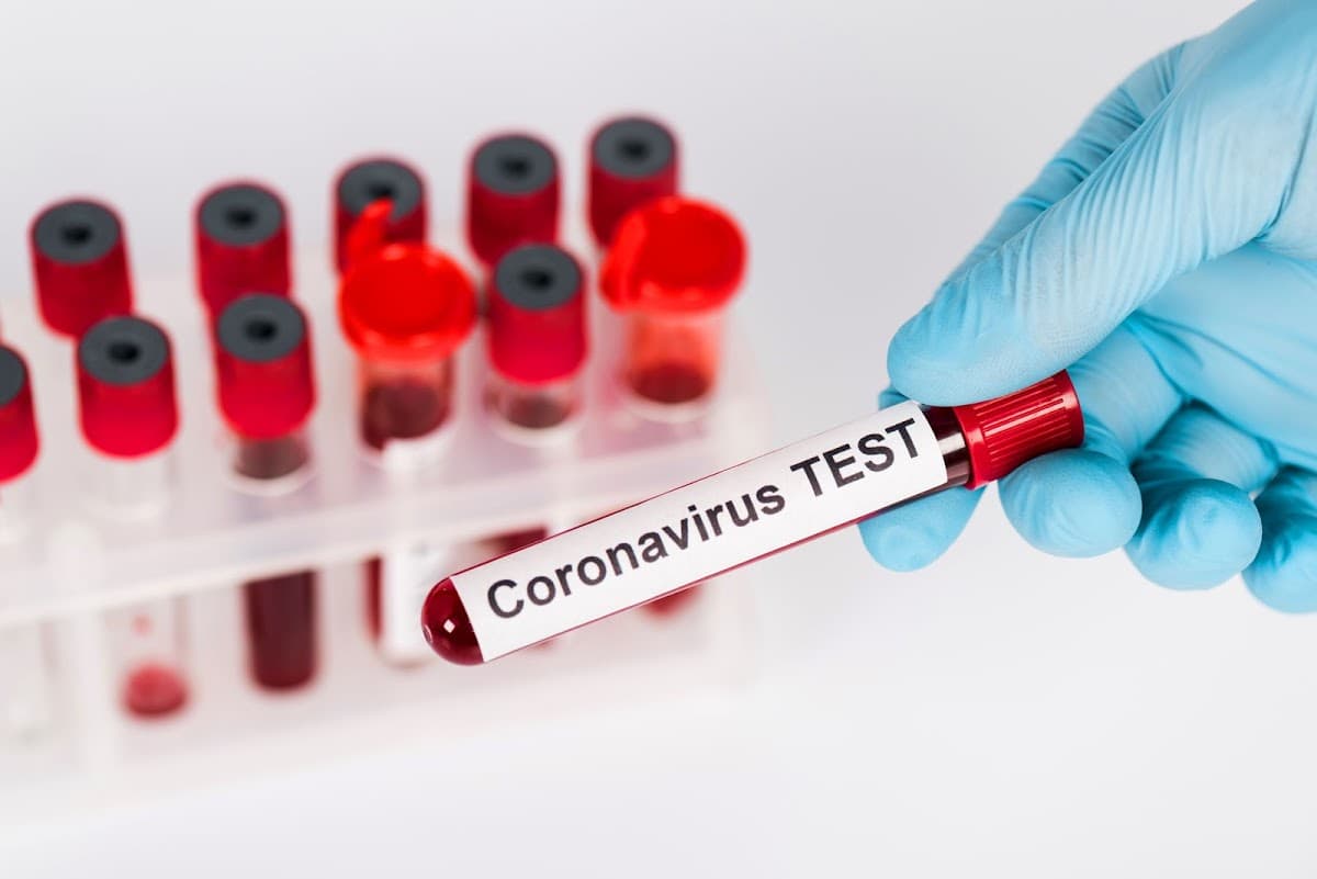 Jharkhand Coronavirus Update : कोरोना से झारखंड में एक दिन में सर्वाधिक मौत, 5 मरीज रांची से, जानें राज्य के ताजा हालात