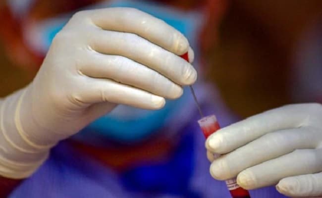 अमेरिका से फैल रहा Covid XBB.1.5 है जानलेवा, फैलने में दूसरे Variant से ज्यादा घातक : Report