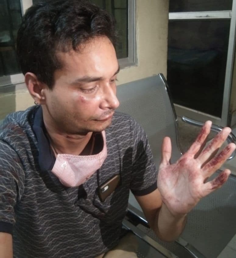 रांची में अधिवक्ता की हत्या के बाद अब झारखंड के महाधिवक्ता के जूनियर एडवोकेट के साथ मारपीट, दो आरोपी गिरफ्तार रांची में अधिवक्ता की हत्या के बाद अब झारखंड के महाधिवक्ता के जूनियर एडवोकेट के साथ मारपीट, दो आरोपी गिरफ्तार