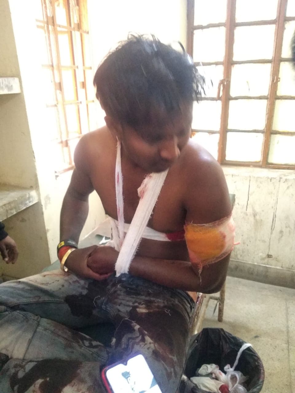 Jharkhand Crime News : झारखंड के चतरा में अपराधियों ने ट्रक एसोसिएशन के अध्यक्ष प्रहलाद सिंह को मारी गोली, हालत गंभीर