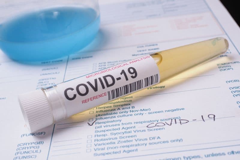 Coronavirus के प्रारंभिक जांच के लिए खर्च करने होंगे बस इतने रुपये