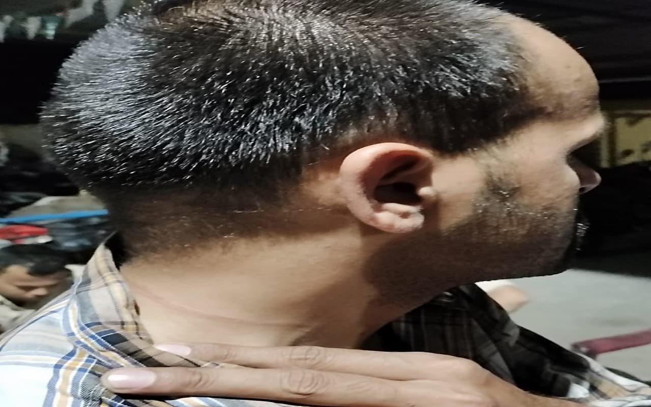 देवघर में बंधक बनाकर पुलिस पर हमला, दिल्ली पुलिस समेत 4 जवान जख्मी, साइबर अपराधी को छुड़ा ले गए ग्रामीण