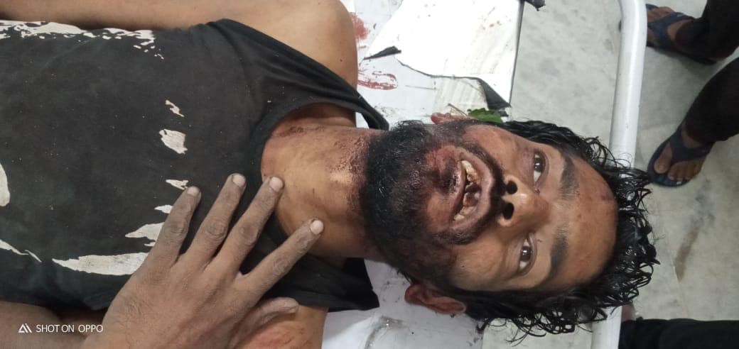 झरिया व्यवसायी का लापता पुत्र मिला गारूई पुराना टोल प्लाजा के पास घायलवस्था में, स्थिति गंभीर