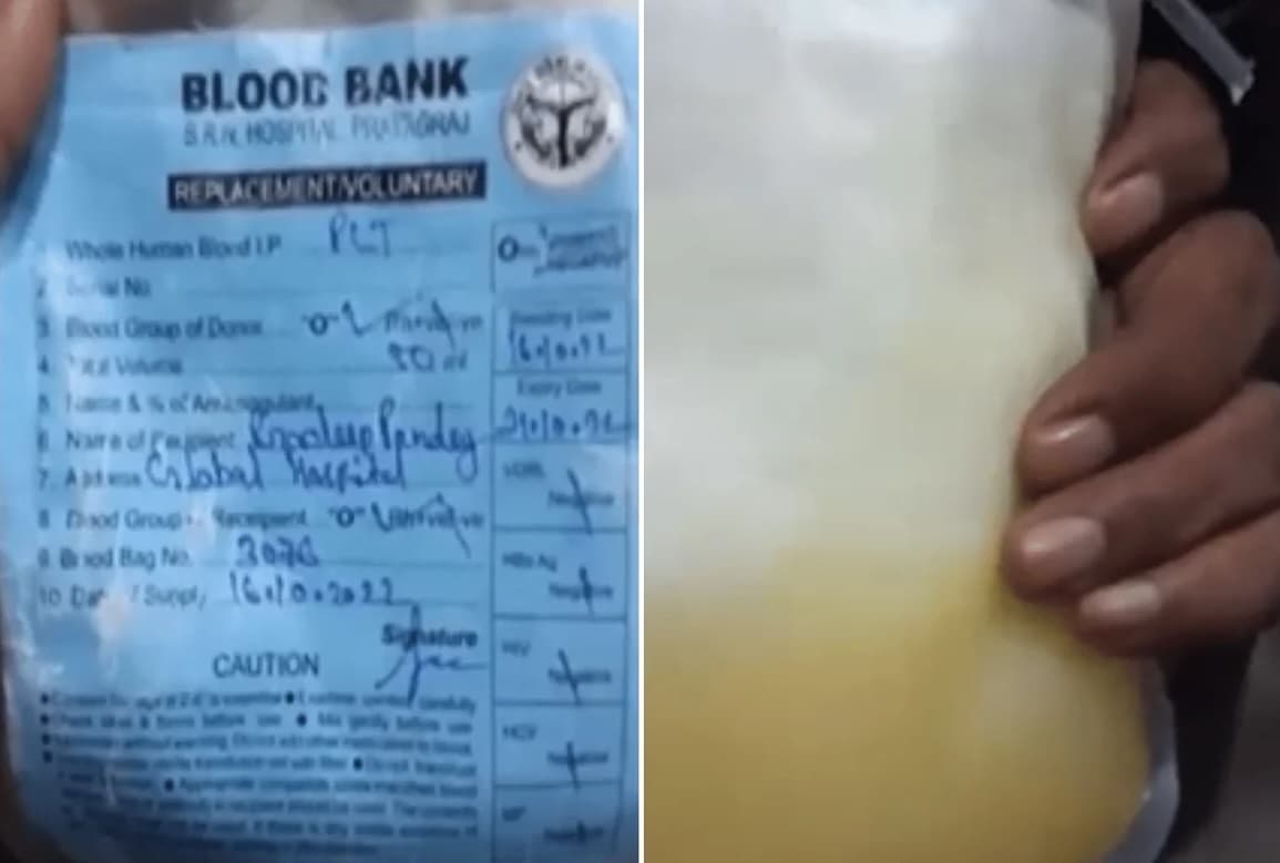 UP News: डेंगू मरीज को प्लाज्मा की जगह चढ़ा दिया मौसमी का जूस, डिप्टी CM के आदेश के बाद सील किया अस्पताल