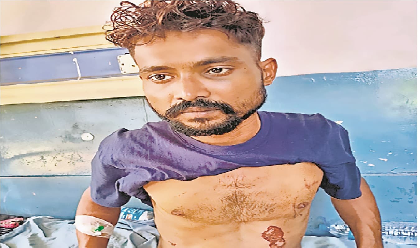 पटना में गर्लफ्रेंड और पत्नी के सामने लुटेरे बिट्टू ने थाने में खुद को लगायी आग, भागने की कोशिश