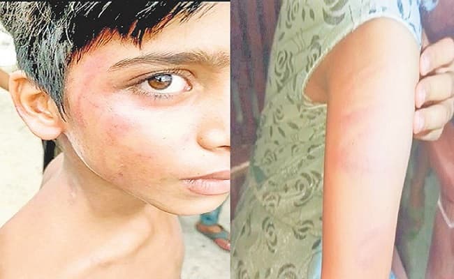 तालीम का क्रूर तरीका! बिहार के मौलवी शिक्षक ने मासूमों को बुरी तरह पीटा, सबक बनाकर नहीं लाने पर किया जख्मी