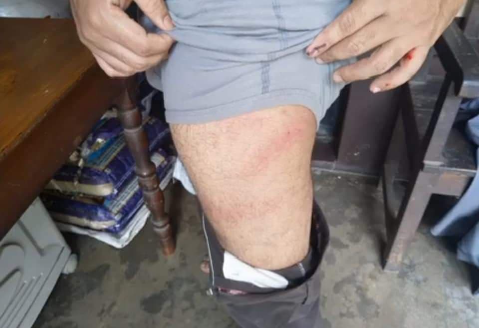 गलसी में मतदान के बीच ममता बनर्जी की पार्टी का बड़ा आरोप, वोट के लिए हिंसा करा रही है बीजेपी