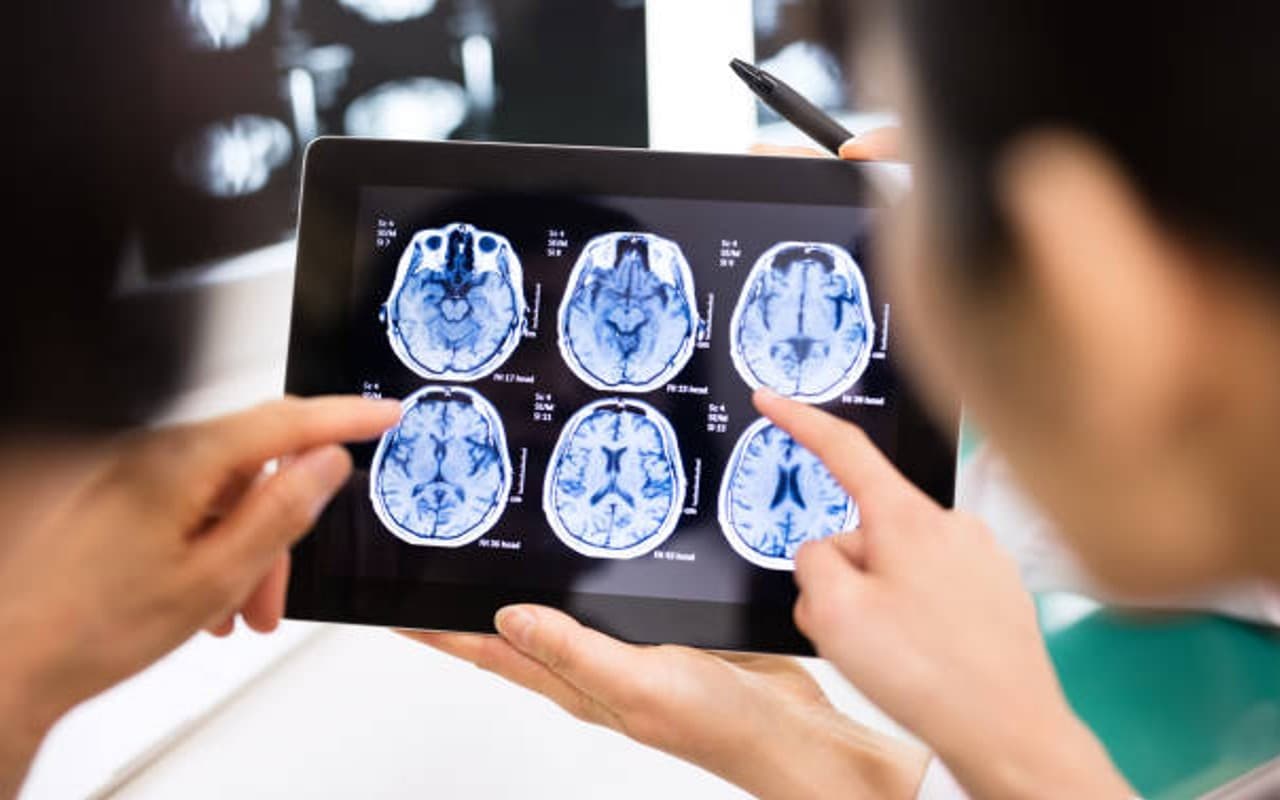 Stroke: स्ट्रोक क्या है और कैसे आता है? जानें इसके लक्ष्ण और बचाव Stroke: स्ट्रोक क्या है और कैसे आता है? जानें इसके लक्ष्ण और बचाव