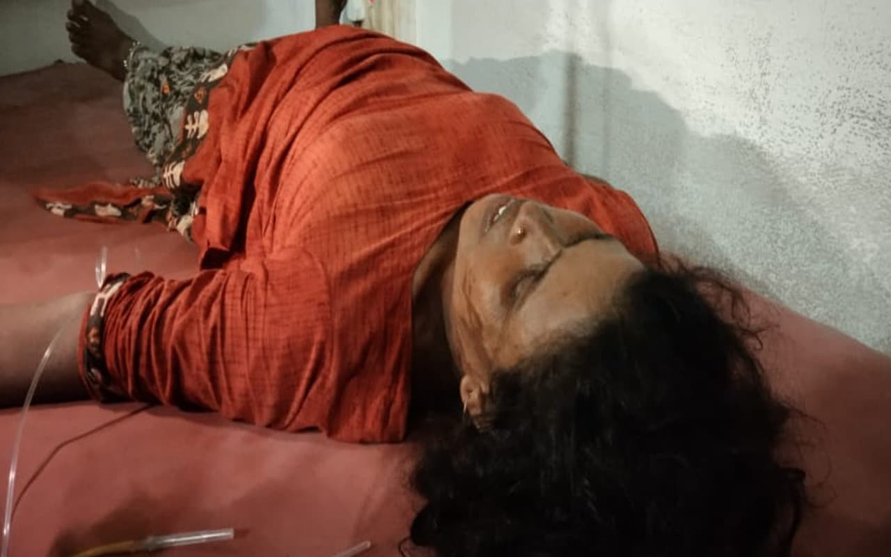 महगामा एसिड अटैक मामले में आरोपी को पुलिस ने किया गिरफ्तार, पीड़िता गोड्डा सदर हॉस्पिटल रेफर