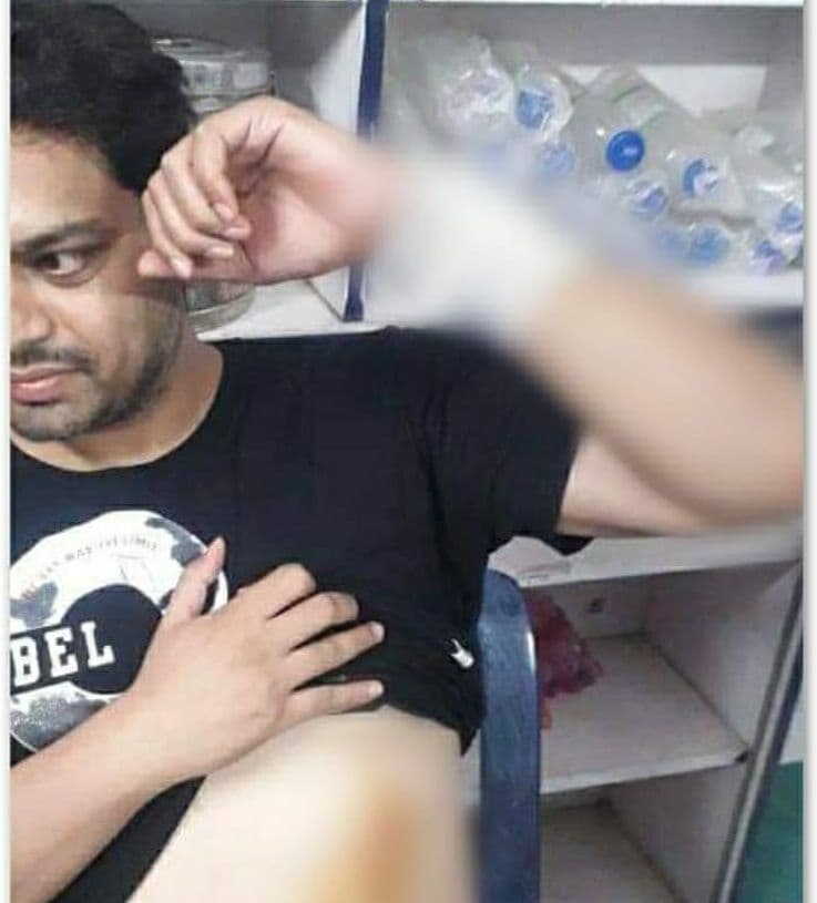 गोड्डा विधायक पर हमला मामले पर होने लगी सुरक्षा की मांग, इन लोगों के खिलाफ हत्या के प्रयास का मामला दर्ज