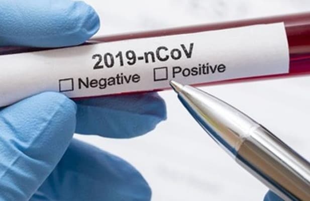 गुमला में कोरोना जांच की 3 में से 2 मशीन खराब, राम भरोसे चल रही है कोरोना जांच, पढ़ें कोरोना से संबंधित सभी लेटेस्ट अपडेट