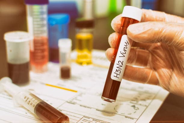 H3N2 Virus : पटना में सर्दी-जुकाम, बुखार के मरीजों की होगी रैपिड जांच, सैंपल को RMRI भेजने के निर्देश