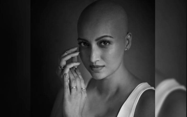 ब्रेस्ट कैंसर से जूझ रहीं एक्ट्रेस Hamsa Nandini, बाल्ड लुक में कराया लेटेस्ट फोटोशूट