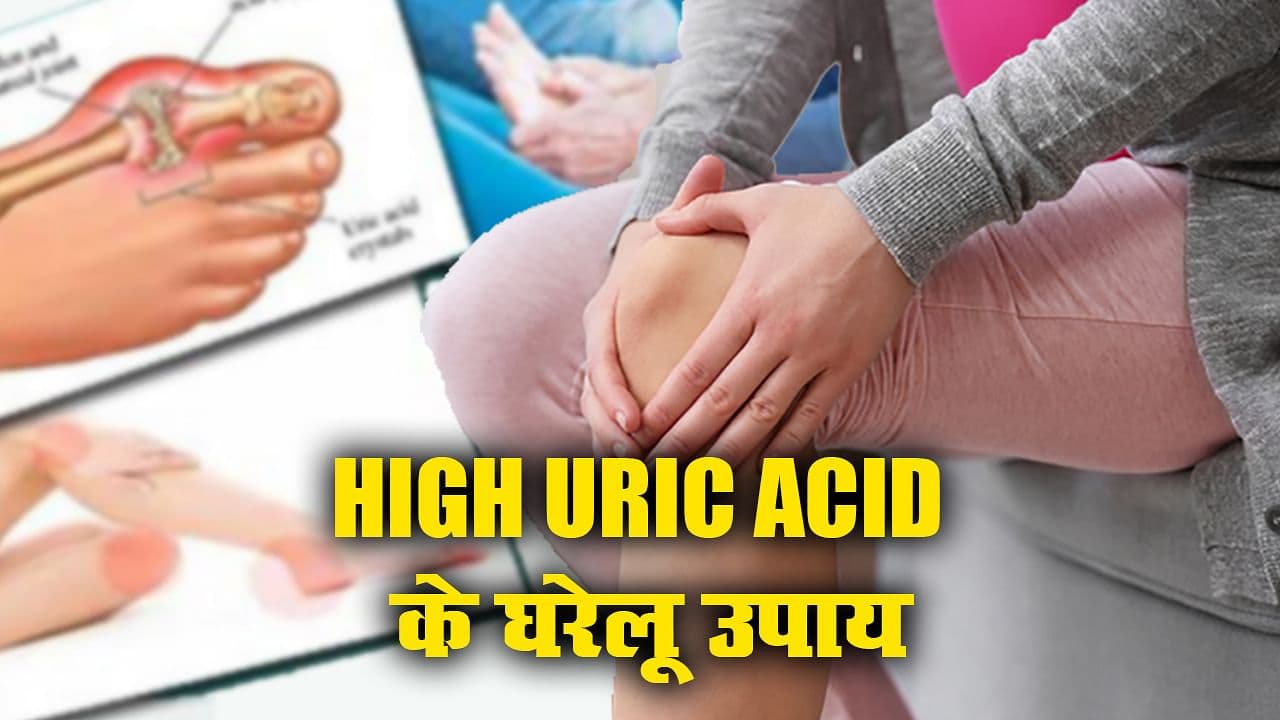 30 की आयु के बाद बढ़ जाता है High Uric Acid का खतरा, इन उपायों से घर पर ही कर सकते हैं कंट्रोल