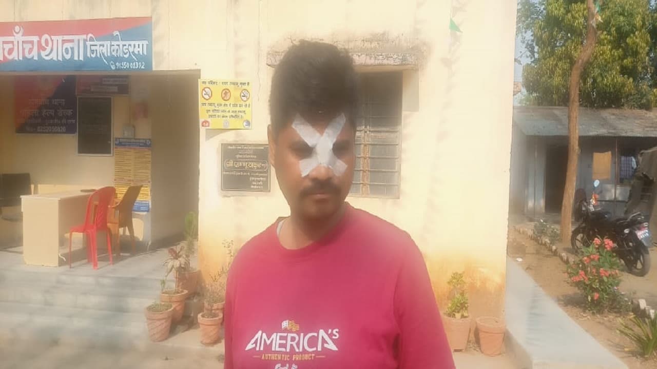 Holi 2022: होली को लेकर दो गुटों में हुई झड़प, शांत कराने गई पुलिस टीम पर पत्थरबाजी, कई पुलिसकर्मी चोटिल