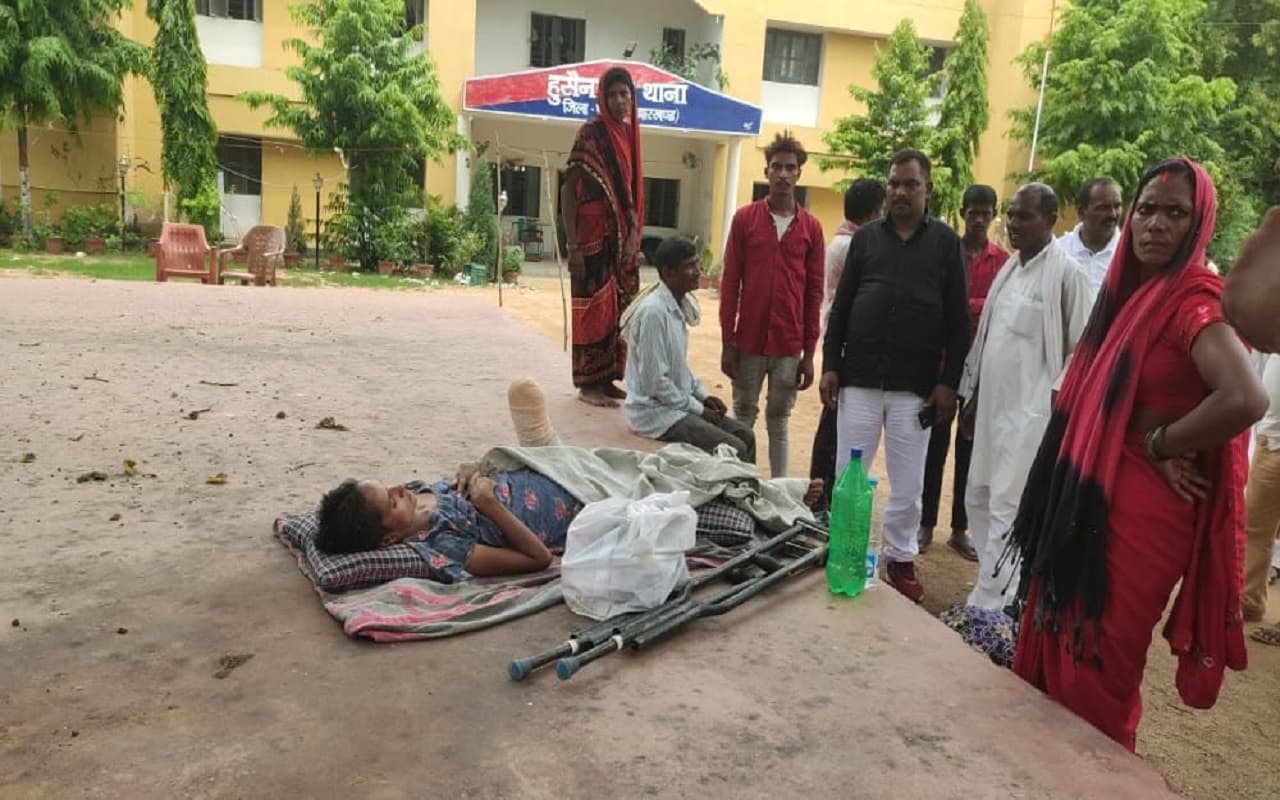 झारखंड में बेरहम पति की करतूत, BHU में इलाज के बहाने ले गया UP, धारदार हथियार से काट डाला पत्नी का पैर