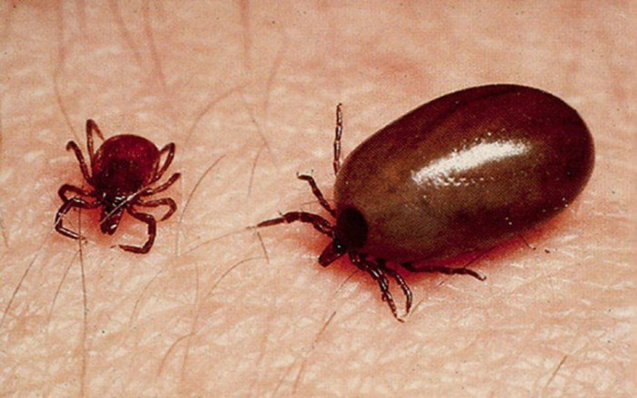 Health: क्या है 'Scrub Typhus'? कैसे फैलता है ये और क्या है इसका इलाज, जानें यहां सबकुछ