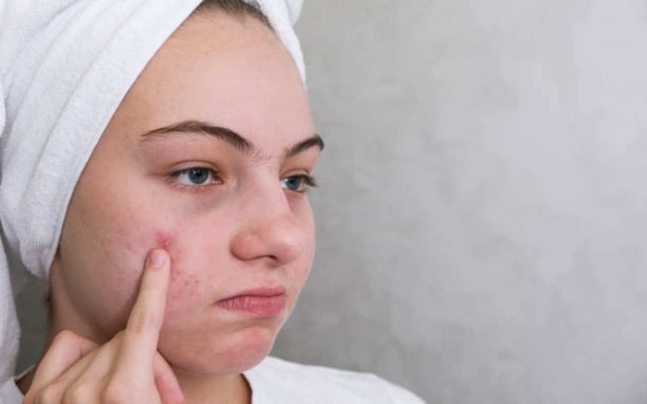 Health Care : हाई कोलेस्ट्रॉल के संकेतों को पहचानें, दिख रहे लक्षणों को न करें नज़रअंदाज