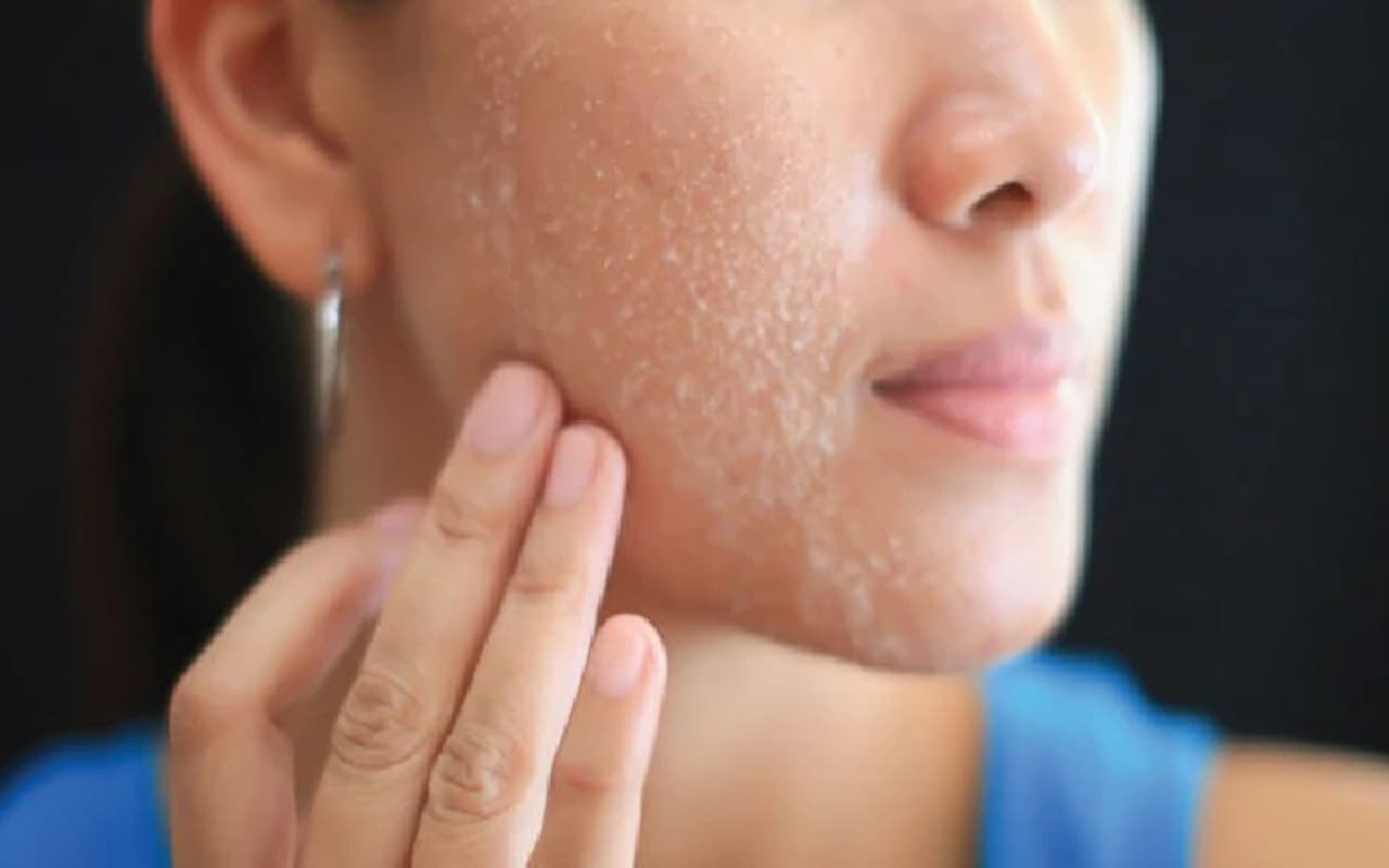 Beauty Tips: सर्दी शुरू होते ही स्किन होने लगी है ड्राई, करें ये नैचुरल उपाय, त्वचा में लौट आएगी नमी